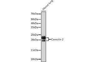 Western blot analysis of extracts of Mouse lung, using Caveolin-2 Rabbit mAb (ABIN7266155) at 1:1000 dilution. (Caveolin 2 anticorps)