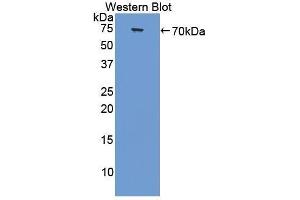 Western Blotting (WB) image for anti-Collagen, Type III, alpha 1 (COL3A1) (AA 1059-1466) antibody (ABIN1858456) (COL3A1 anticorps  (AA 1059-1466))