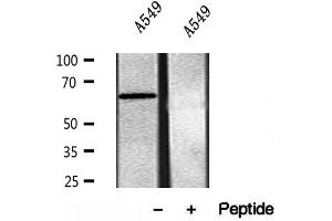 Western blot analysis of extracts of A549 cells, using SQLE antibody.