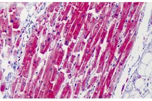 Human Heart: Formalin-Fixed, Paraffin-Embedded (FFPE)
