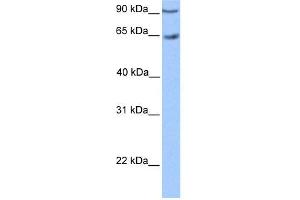 WB Suggested Anti-ZNF449 Antibody Titration:  0. (ZNF449 anticorps  (C-Term))