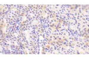 Detection of GOLPH2 in Human Kidney Tissue using Polyclonal Antibody to Golgi Phosphoprotein 2 (GOLPH2)