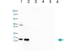 Western Blot analysis of (1) 25 ug whole cell extracts of Hela cells, (2) 15 ug histone extracts of Hela cells, (3) 1 ug of recombinant histone H2A, (4) 1 ug of recombinant histone H2B, (5) 1 ug of recombinant histone H3, (6) 1 ug of recombinant histone H4. (Histone H2B anticorps  (acLys15))