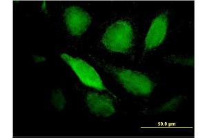 Immunofluorescence of monoclonal antibody to PTX3 on HeLa cell. (PTX3 anticorps  (AA 282-380))