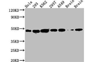 Western Blot Positive WB detected in: Hela whole cell lysate, 293 whole cell lysate, K562 whole cell lysate, 293T whole cell lysate, A549 whole cell lysate, Rat Brain whole cell lysate, Mouse Brain whole cell lysate All lanes: NUDC antibody at 1:1000 Secondary Goat polyclonal to rabbit IgG at 1/50000 dilution Predicted band size: 39 kDa Observed band size: 45 kDa (Recombinant NUDC anticorps)