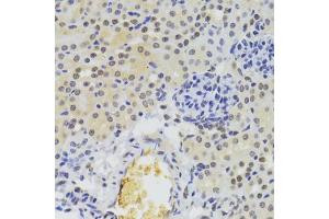 Immunohistochemistry of paraffin-embedded mouse kidney using HNRNPA1 Antibody (ABIN5975570) at dilution of 1/100 (40x lens). (HNRNPA1 anticorps)