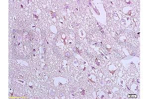 Formalin-fixed and paraffin embedded:  rat brain tissue labeled with Anti-Bax Polyclonal Antibody, unconjugated  (ABIN725390)  at 1: 800 followed by incubation with conjugated secondary antibody and DAB staining (BAX anticorps  (AA 84-175))