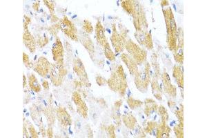 Immunohistochemistry of paraffin-embedded Rat heart using CTGF Polyclonal Antibody at dilution of 1:100 (40x lens). (CTGF anticorps)