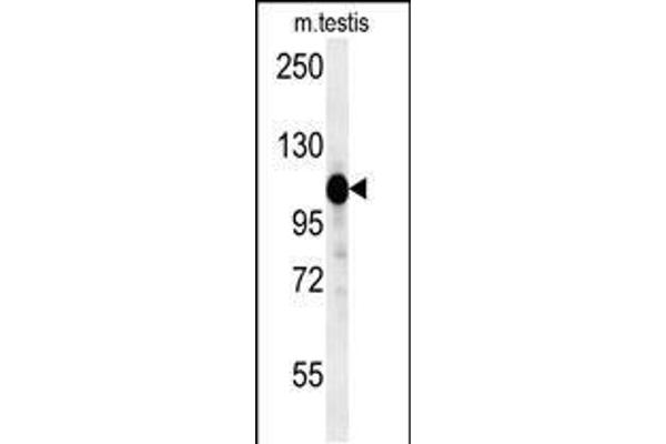 DACT1 antibody  (N-Term)
