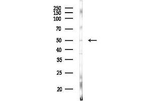 Western blot analysis of lysates from HUVEC cells(heat-shock, 45 min treatment), using KCNJ14 Antibody at 1/1000 dilution. (KCNJ14 anticorps  (C-Term))