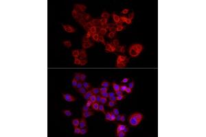 Immunofluorescence analysis of HCT116 cells using F Rabbit pAb (ABIN6127814, ABIN6140422, ABIN6140423 and ABIN6221993) at dilution of 1:200 (40x lens).