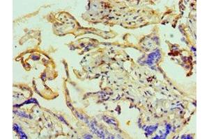 Immunohistochemistry of paraffin-embedded human placenta tissue using ABIN7144073 at dilution of 1:100 (ANAPC5 anticorps  (AA 1-250))
