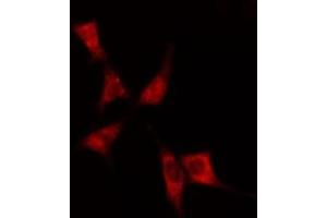 ABIN6275060 staining  Hela cells by IF/ICC. (DHODH anticorps  (Internal Region))