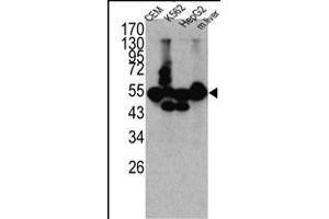 Western blot analysis of CPN1 antibody (N-term) (ABIN391509 and ABIN2841471) in K562, CEM, HEpG2 cell line lysates and mouse liver tissue lysates (35 μg/lane).