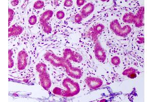 Anti-PDGFA antibody IHC of human breast, epithelium. (PDGF-AA Homodimer anticorps)