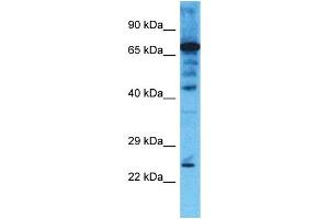 Host: Rabbit  Target Name: CHMP4B  Sample Tissue: Jurkat Whole Cell lysates  Antibody Dilution: 1.