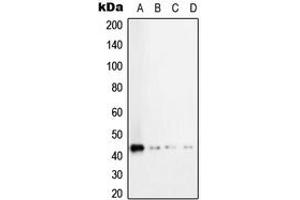 Western blot analysis of TGF beta 1 expression in HeLa (A), MCF7 (B), SP2/0 (C), H9C2 (D) whole cell lysates. (TGFB1 anticorps  (C-Term))