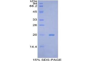 SDS-PAGE analysis of Mouse Bcl2L2 Protein. (BCL2L2 Protéine)