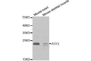 Western blot analysis of extracts of various cell lines, using ATF3 antibody. (ATF3 anticorps  (AA 1-181))