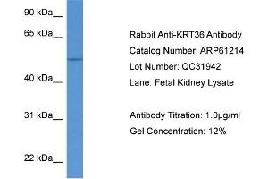 Western Blotting (WB) image for anti-Keratin 36 (KRT36) (N-Term) antibody (ABIN2788722)