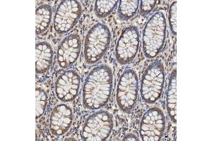 IHC analysis of Mitochondrial Dicarboxylate Carrier/SLC25A10 using anti-Mitochondrial Dicarboxylate Carrier/SLC25A10 antibody (ABIN7601497).