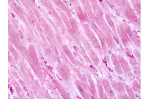 Anti-PTPRA antibody IHC of human heart.