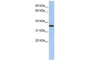 FAM84A antibody used at 1 ug/ml to detect target protein. (FAM84A anticorps  (N-Term))