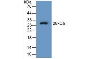 Detection of Recombinant PAH, Human using Polyclonal Antibody to Phenylalanine Hydroxylase (PAH)