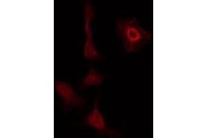 ABIN6266610 staining HUVEC by IF/ICC.