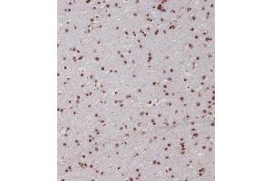 Immunohistochemical analysis of (ABIN656884 and ABIN2846084) on paraffin-embedded Human brain tissue was performed on the Leica®BOND RXm.