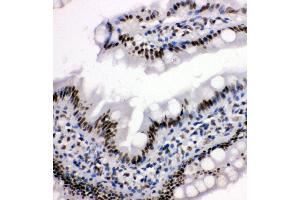 Anti-HDAC3 antibody,  IHC(P) IHC(P): Rat Intestine Tissue