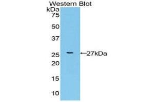 Western Blotting (WB) image for anti-Fibroblast Growth Factor Receptor-Like 1 (FGFRL1) (AA 168-378) antibody (ABIN3202407) (FGFRL1 anticorps  (AA 168-378))