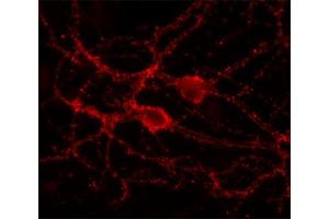 Indirect immunolabeling of cultured rat hippocampus neurons (dilution 1 : 500).