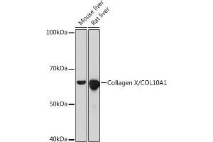 Western blot analysis of extracts of various cell lines, using Collagen X/COL10 Rabbit mAb (1645) at 1:1000 dilution. (COL10A1 anticorps)