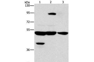 Western Blot analysis of Human bladder carcinoma tissue and A172 cell, Human brain malignant glioma tissue using STK4 Polyclonal Antibody at dilution of 1:1000 (STK4 anticorps)