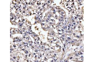 IHC analysis of GHITM using anti-GHITM antibody (ABIN7599294). (GHITM anticorps  (AA 1-345))