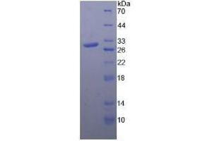 SDS-PAGE analysis of Rat Toll Like Receptor 4 Protein. (TLR4 Protéine)