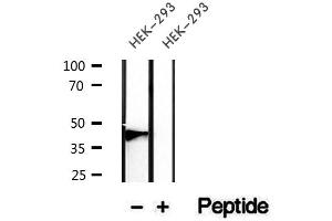 Western blot analysis of extracts of HEK-293 cells, using Podoplanin antibody. (Podoplanin anticorps  (N-Term))