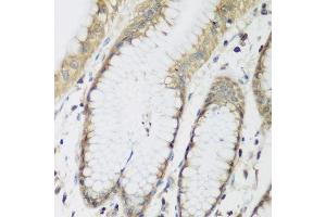 Immunohistochemistry of paraffin-embedded human stomach using METTL7A antibody. (METTL7A anticorps  (AA 30-244))