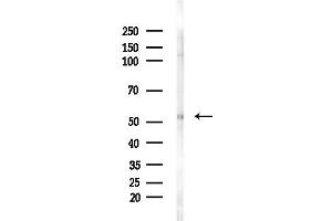 anti-Glycine Receptor, alpha 1 (GLRA1) (Internal Region) antibody