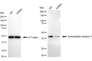 Western blotting analysis using Somatostatin receptor 5 antibody (ABIN7800403).