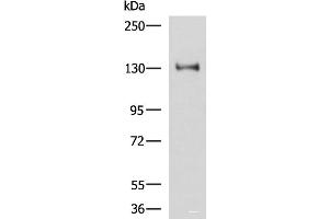 Western blot analysis of Hela cell lysate using PRPF40A Polyclonal Antibody at dilution of 1:800 (PRPF40A anticorps)
