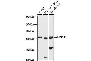Western blot analysis of extracts of various cell lines, using MG antibody (ABIN6131880, ABIN6143811, ABIN6143812 and ABIN6224904) at 1:1000 dilution. (MGAT2 anticorps  (AA 178-447))
