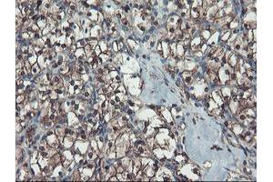 Image no. 8 for anti-serpin Peptidase Inhibitor, Clade B (Ovalbumin), Member 1 (SERPINB1) (AA 77-306) antibody (ABIN1491671)