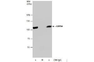 IP Image Immunoprecipitation of GRP94 protein from HeLa whole cell extracts using 5 μg of GRP94 antibody [N1N3], Western blot analysis was performed using GRP94 antibody [N1N3], EasyBlot anti-Rabbit IgG  was used as a secondary reagent.