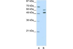 WB Suggested Anti-ZNF682 Antibody Titration:  2. (ZNF682 anticorps  (N-Term))