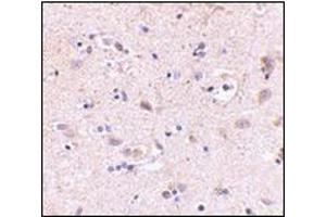 Immunohistochemistry of SATB2 in human brain with this product at 5 μg/ml. (SATB2 anticorps  (C-Term))