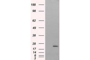 HEK293T cells were transfected with the pCMV6-ENTRY control (Left lane) or pCMV6-ENTRY NIT2 (Right lane) cDNA for 48 hrs and lysed. (NIT2 anticorps)