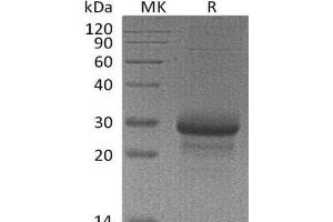 Western Blotting (WB) image for Mannose-Binding Lectin (Protein C) 2, Soluble (MBL2) protein (ABIN7320615) (MBL2 Protéine)