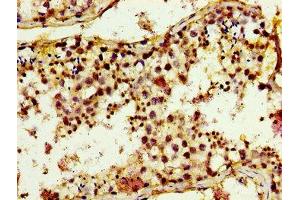 Immunohistochemistry of paraffin-embedded human testis tissue using ABIN7173435 at dilution of 1:100 (TRIM3 anticorps  (AA 285-487))